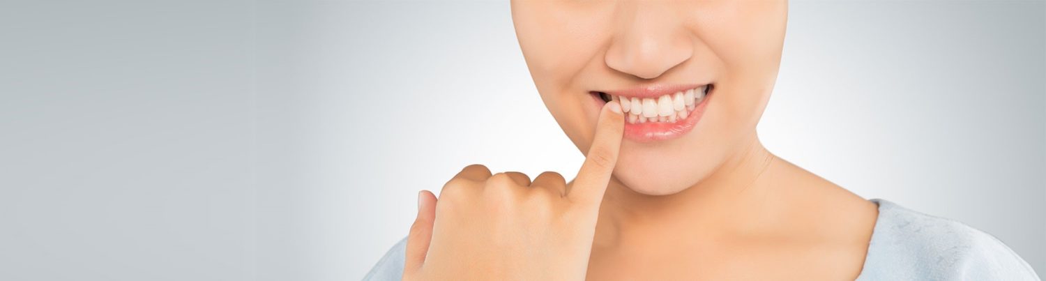 teeth whitening in Lucknow