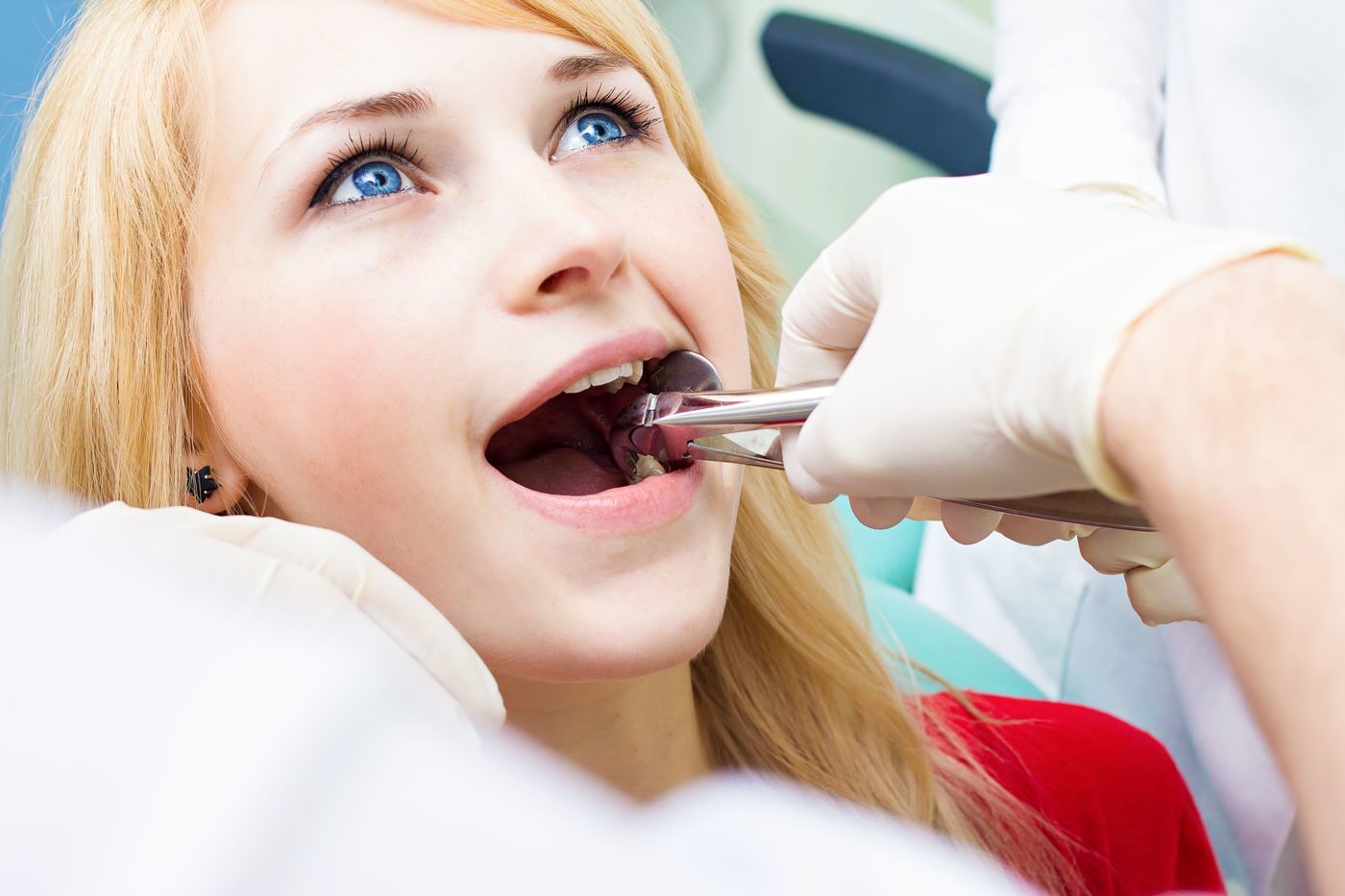 Tooth Extraction in Lucknow