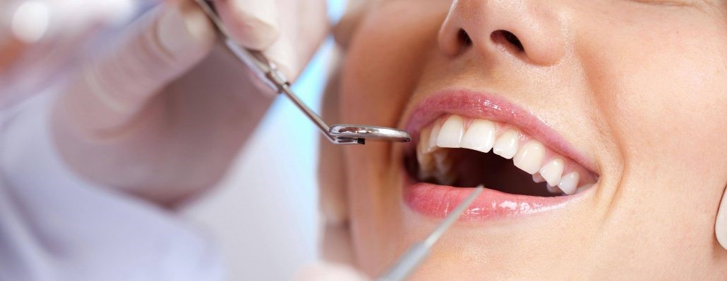 Teeth Cleaning in Lucknow