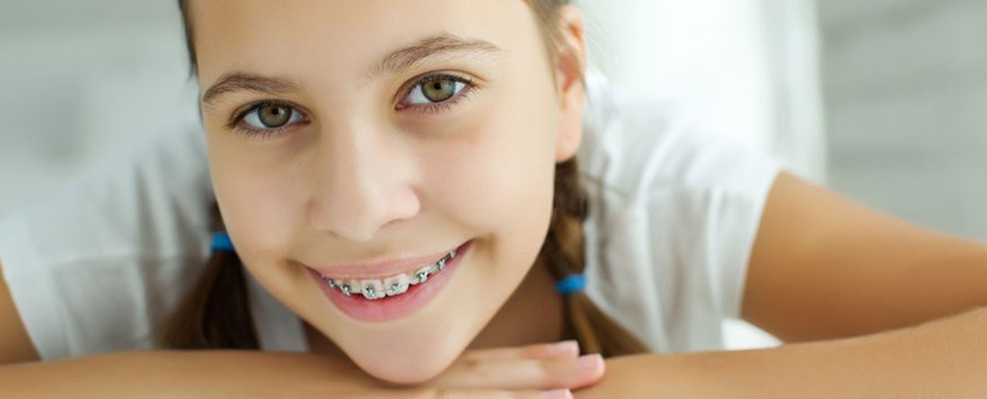 Orthodontic Treatment in Lucknow