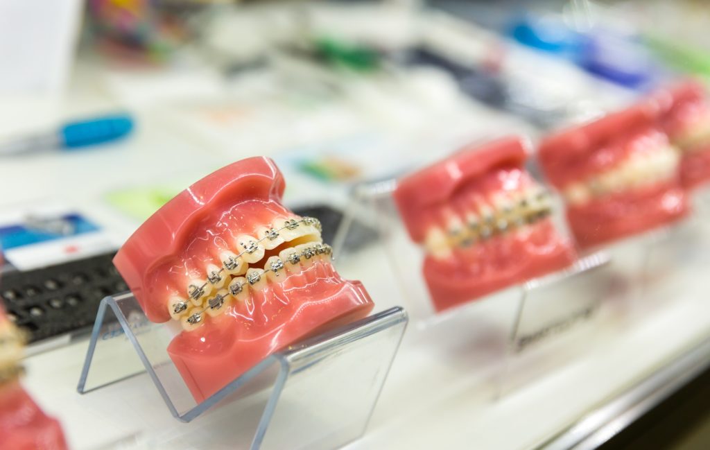 Dental, medicine equipment, orthodontic