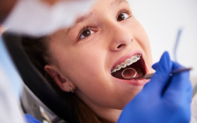 Types of Orthodontic Treatment: Braces, Clear Aligners, and More
